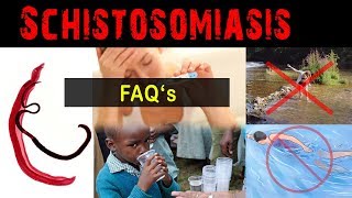 Why amp what is schistosomiasis   FAQ [upl. by Hotchkiss]