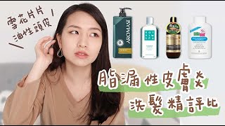 敏感性頭皮 洗髮精怎麼挑選？抗屑洗髮精大評比｜艾瑪絲、施巴洗髮精、艾瑪花園、甘菊洗髮精｜油性頭皮、頭皮屑 [upl. by Patrick528]