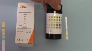 how to use a urine dipstick [upl. by Atiker]