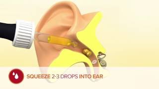 How to use Otex Olive Oil Ear Drops [upl. by Aihsenyt20]