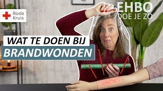 Wat moet je doen bij een brandwond  Rode Kruis EHBO [upl. by Danie87]