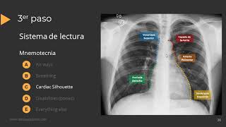 Tutorial Radiografía de Torax [upl. by Soll]