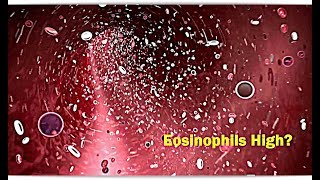 Eosinophils High Low – Causes [upl. by Ycram174]