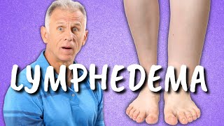 Best Supplements for Lipedema Dercums and Lymphedema Swelling amp Fat Loss  Atlanta Lymphedema Doc [upl. by Atirahs]