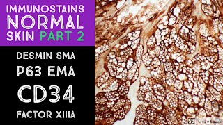 Immunohistochemistry in Normal Skin p63 EMA desmin SMA CD34 Factor XIIIa [upl. by Myrna]