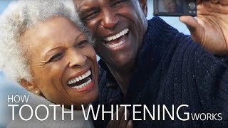 How Tooth Whitening Works [upl. by Raman]