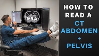 Radiology How to Read a CT Abdomen amp Pelvis My search pattern [upl. by Annasor268]