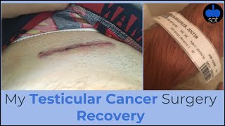 My Testicular Cancer Surgery Recovery [upl. by Lovel]