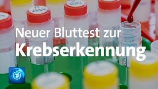 Diagnose Brustkrebs Jung und tödlich krank [upl. by Larcher]