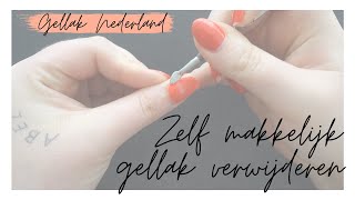 GELLAK VERWIJDEREN  Uitgebreide uitleg  Gellak Nederland [upl. by Whitelaw363]