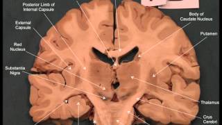 Neuroanatomy  Coronal Brain Slices [upl. by Bruis608]