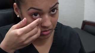 How to Apply Ointment to the Eyes and Eyelids [upl. by Fricke]