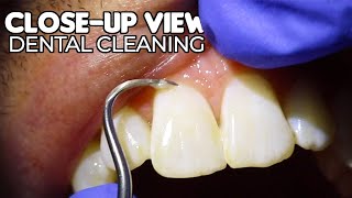 Dental Cleaning  CloseUp View ASMR [upl. by Itida]