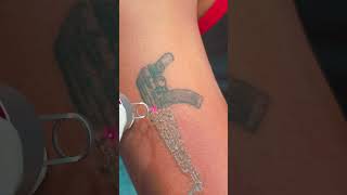 Gun laser tattoo removal [upl. by Leilani]