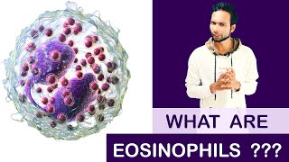 A patients experience with eosinophilic esophagitis [upl. by Ahsirt]