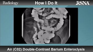 Air C02 DoubleContrast Barium Enteroclysis How I Do It [upl. by Erlina694]