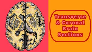 Transverse and Coronal Brain Sections [upl. by Westhead166]