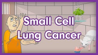 Small Cell Lung Cancer Small Cell Carcinoma  USMLE Step 1 Mnemonic [upl. by Norene]