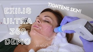 EXILIS ULTRA DEMONSTRATION FACE  Exilis Ultra 360 Experience at EuroPhoria [upl. by Enala]