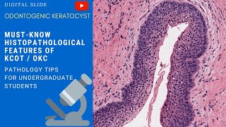 Odontogenic Keratocyst Histopathology [upl. by Peppie]