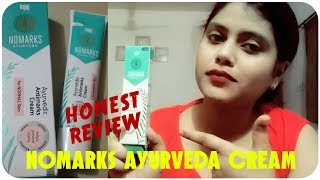 New Bajaj Nomarks Ayurvedic Antimarks Cream Review  Honest Review  By Tips And Tricks in Hindi [upl. by Assilaj]