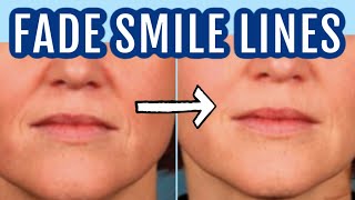 12 ways to fade smile lines nasolabial folds Dr Dray [upl. by Einnoj958]