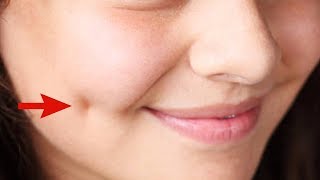 How To Get Dimples Fast And Naturally Beauty Tips [upl. by Nevil]