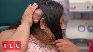 A Life Destroying Bump  Dr Pimple Popper [upl. by Connelley195]