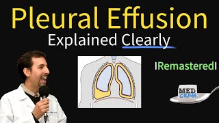 Pleural Effusions  Causes Diagnosis Symptoms Treatment [upl. by Fleck]