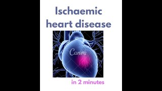 Ischemic Heart Disease in under 2 mins [upl. by Hsakiv]