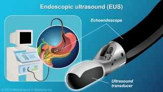 Understanding EUSFNA [upl. by Jerman]