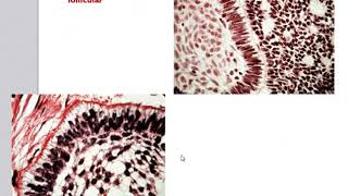 Odontogenic Tumors [upl. by Alket]