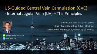 UltrasoundGuided Internal Jugular Vein Cannulation  Principles Part 1 [upl. by Jacinto219]