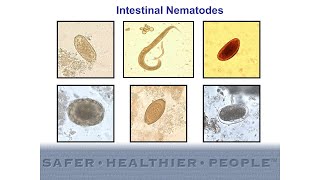 Diagnostic Features of Intestinal Nematodes [upl. by Adyl60]