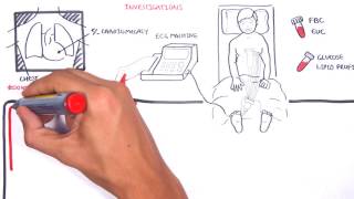 Acute Coronary Syndrome DETAILED Overview MI STEMI NSTEMI [upl. by Deedee825]