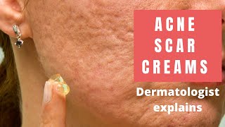 HOW TO GET RID OF ACNE SCARS AND DARK MARKS FAST  DIY TURMERIC HONEY LEMON AND ALOE FACE MASK [upl. by Aneri]