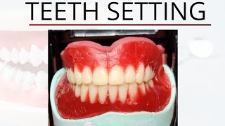 Complete Teeth Setting  Prosthodontics [upl. by Eilyab]