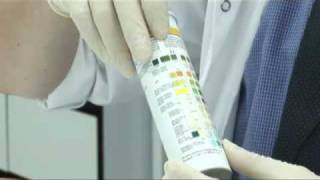 Urine Analysis [upl. by Liahcim]