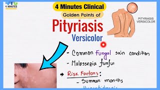 Pityriasis Versicolor Explained Like Water  Symptoms Pathogenesis Treatment  4 Minutes Clinical [upl. by Yedoc]