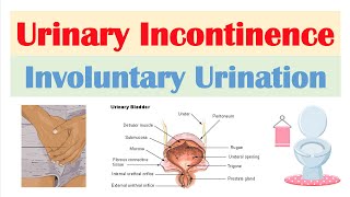 Urinary Incontinence amp Urgency Causes symptoms Treatment amp Prevention [upl. by Eeldarb]