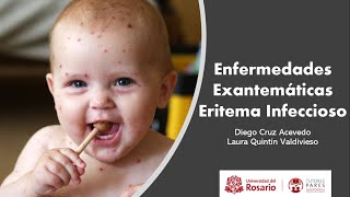 Enfermedades Exantemáticas Eritema infeccioso [upl. by Inavihs]