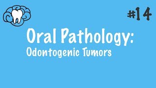 Oral Pathology  Odontogenic Tumors  INBDE ADAT [upl. by Harp207]