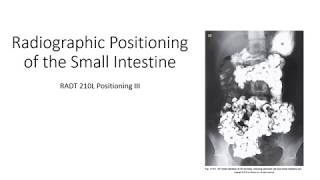 Radiographic Positioning of the Small Intestine [upl. by Ronny]