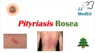 Introduction to Pityriasis Rosea  Possible Causes Symptoms and Treatment [upl. by Annoj]