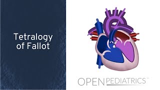 Tetralogy of Fallot with Pulmonary Regurgitation [upl. by Engelbert132]