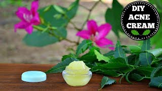 Acne Scar Creams  Dermatologist Reviews [upl. by Elfreda]