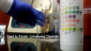 How to Urine Urinalysis Dipstick Lab Test [upl. by Fidelity]