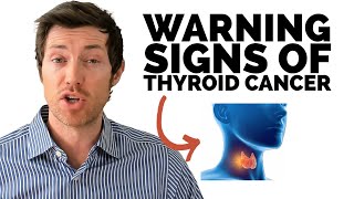 Thyroid Cancer Symptoms amp Early Warning Signs [upl. by Joaquin]