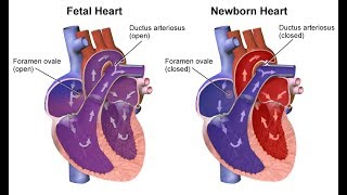 ¿Qué son las cardiopatías congénitas [upl. by Savart]