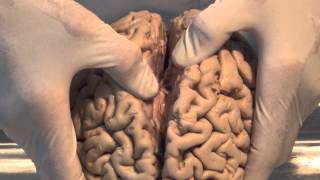 Introduction Neuroanatomy Video Lab  Brain Dissections [upl. by Aloeda]